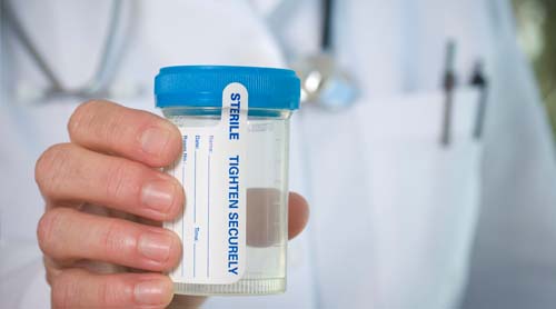 Saliva vs. Urine Drug Testing